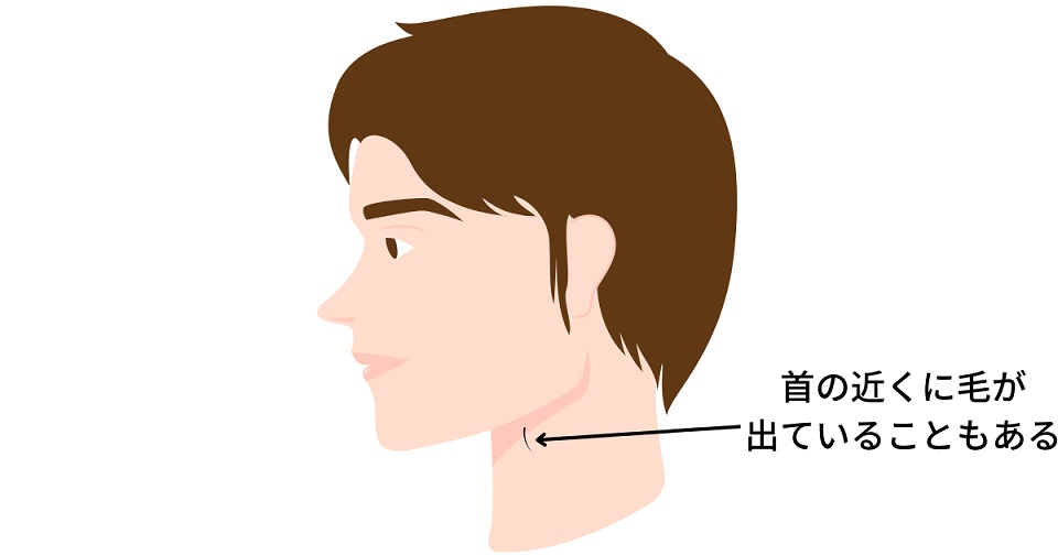 首の近くに毛が出ていることもある